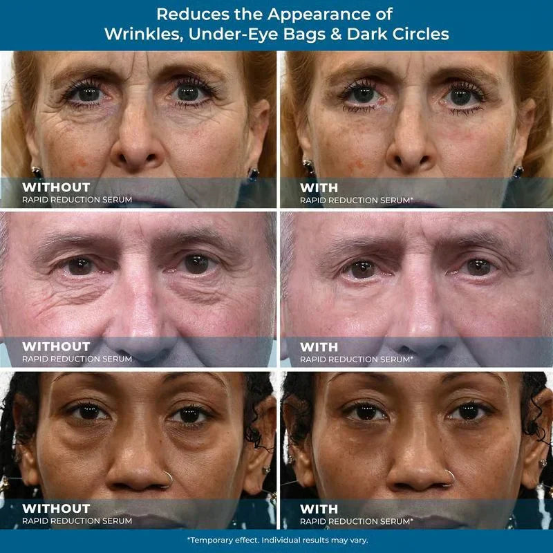 Rapid Reduction Eye Serum – Instant Tightening & Anti-Aging for Eyes & Face ✨