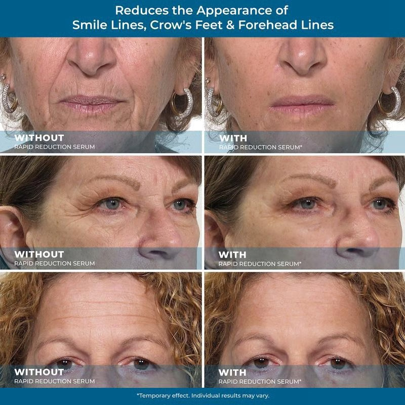 Rapid Reduction Eye Serum – Instant Tightening & Anti-Aging for Eyes & Face ✨