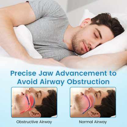 Last Day Promotion ⏰ PerfectSleep Solution- Anti-Snoring & Anti-Grinding Teeth Protector